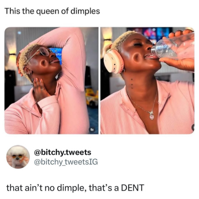 DENT 😂😂